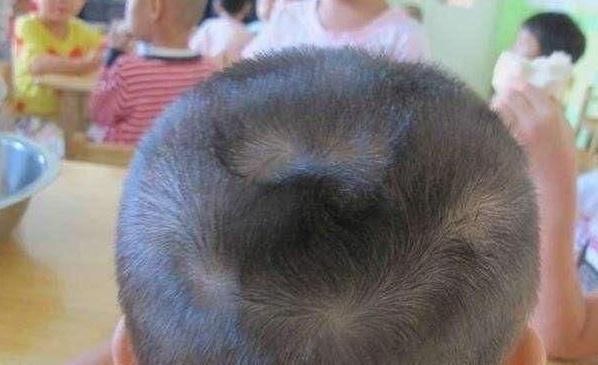 宝宝脑袋上头旋原来是这样形成,你们猜对了吗?!