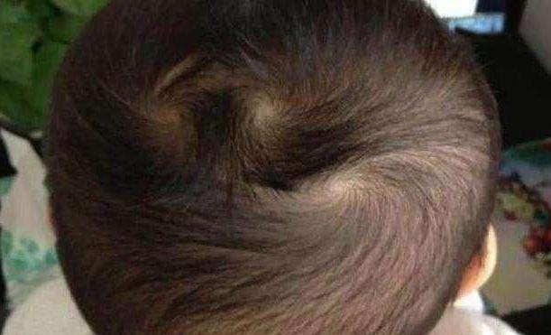 宝宝脑袋上头旋原来是这样形成,你们猜对了吗?!